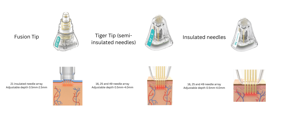 Potenza RF Microneedling Patented Tips